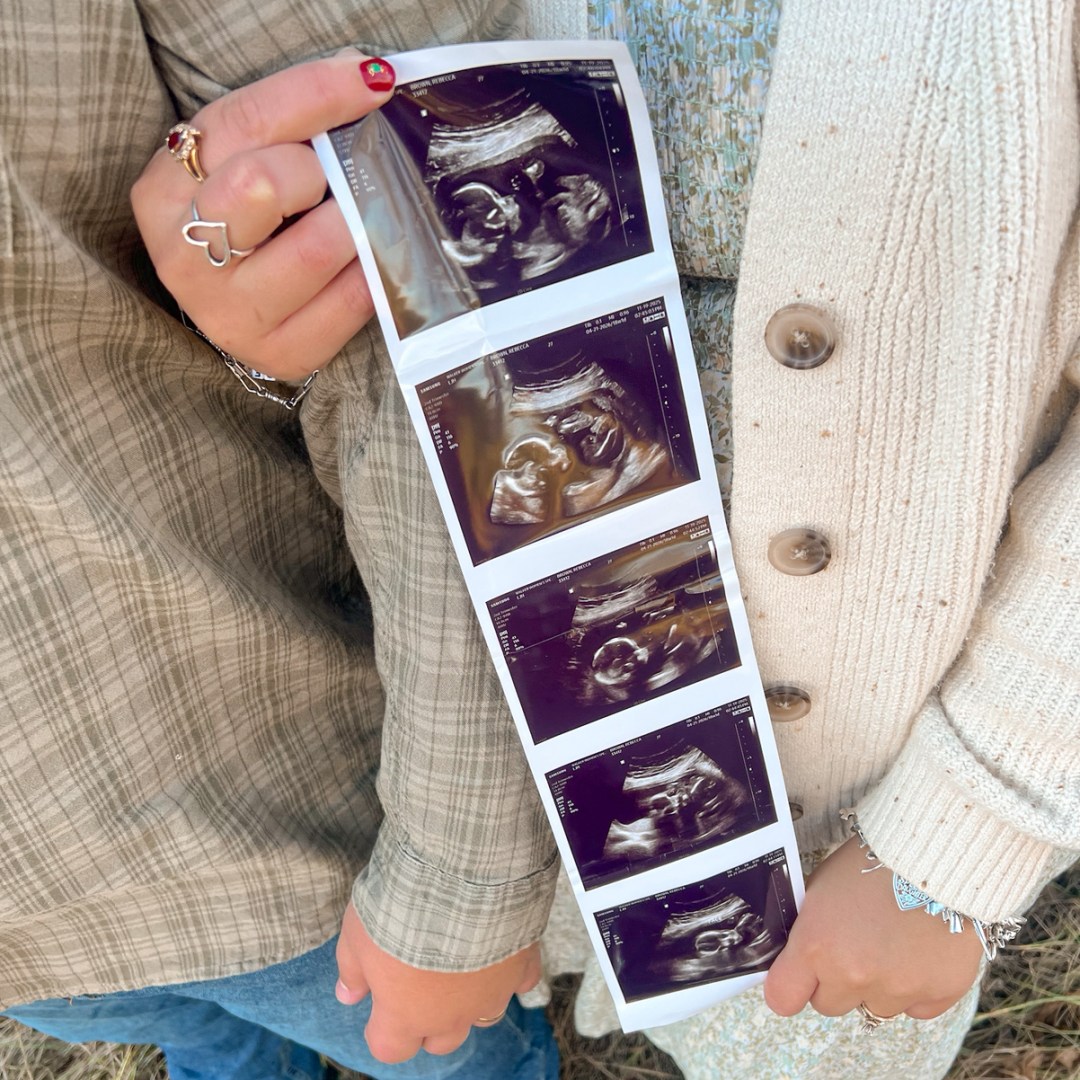 Photo shared by Rebecca for their Babylist baby registry.