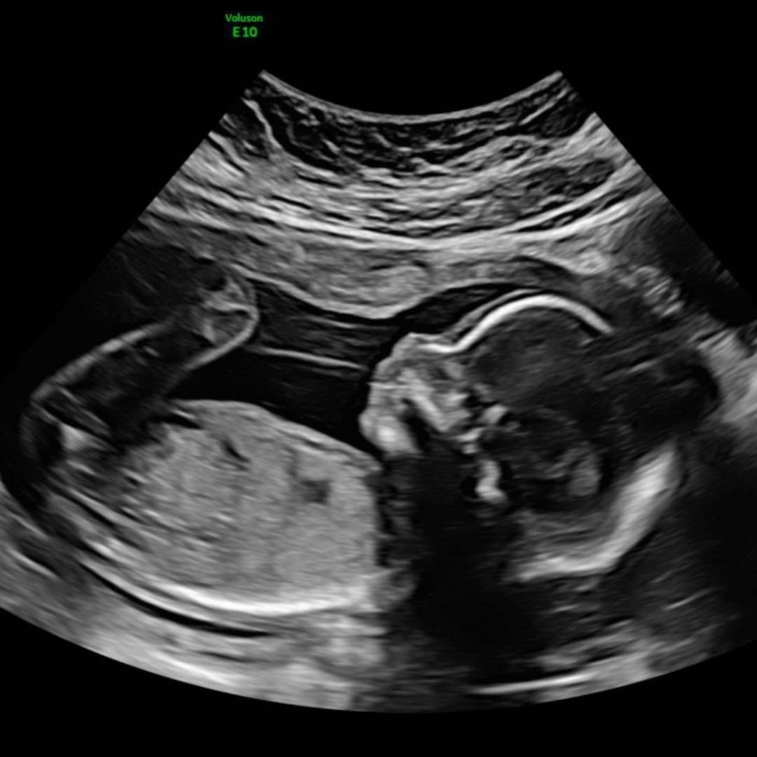 Photo shared by Xenixis for their Babylist baby registry.