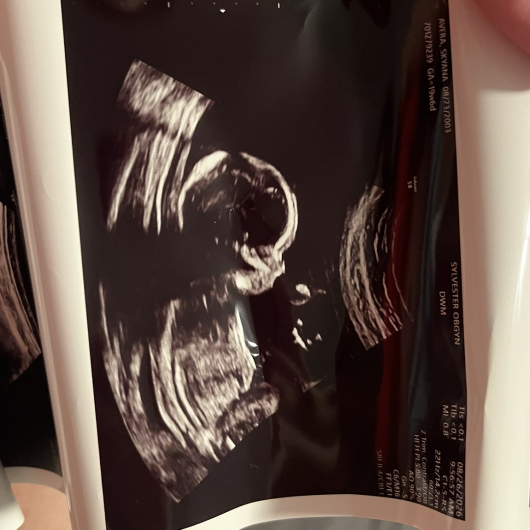 Photo shared by Skyana for their Babylist baby registry.