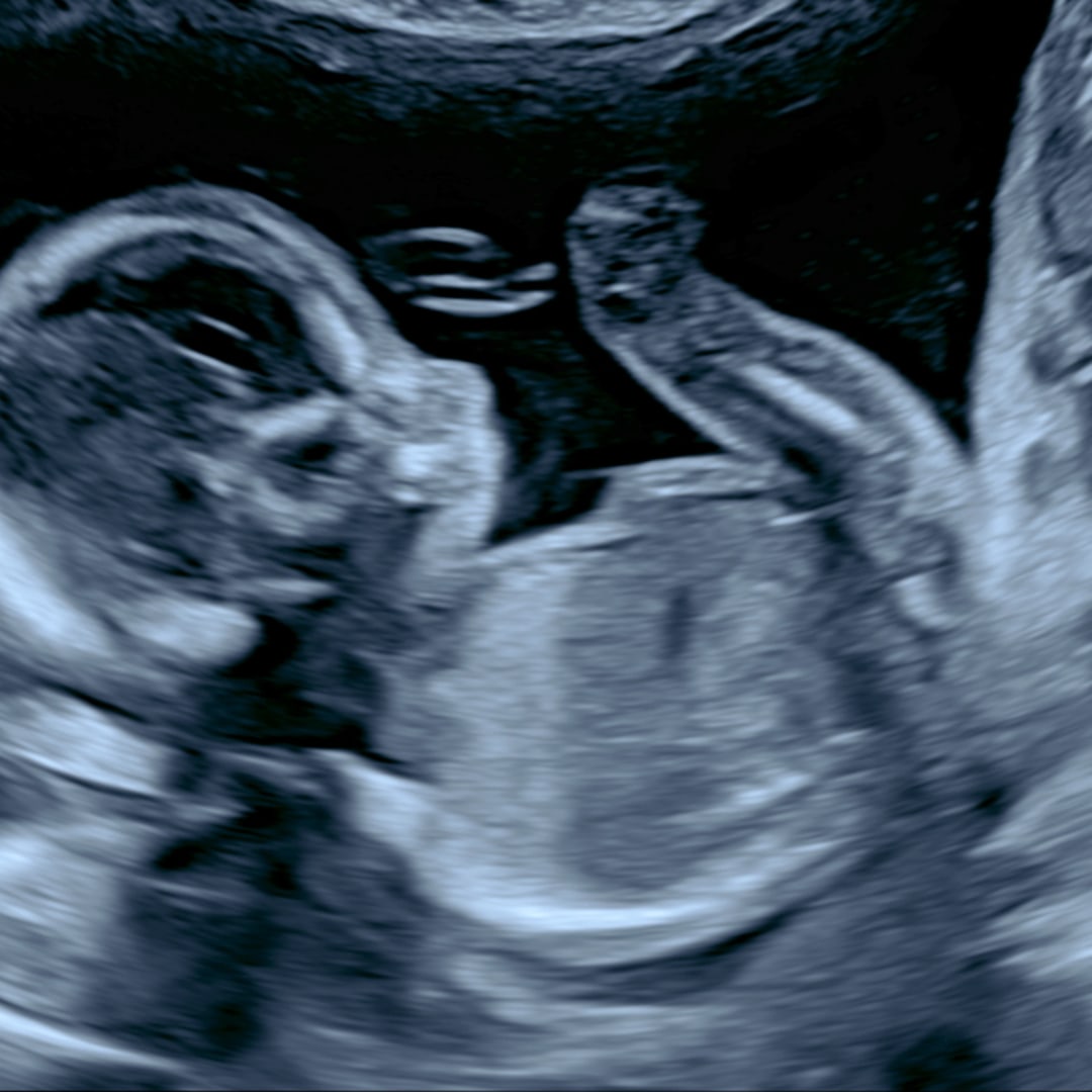 Photo shared by Mark for their Babylist baby registry.