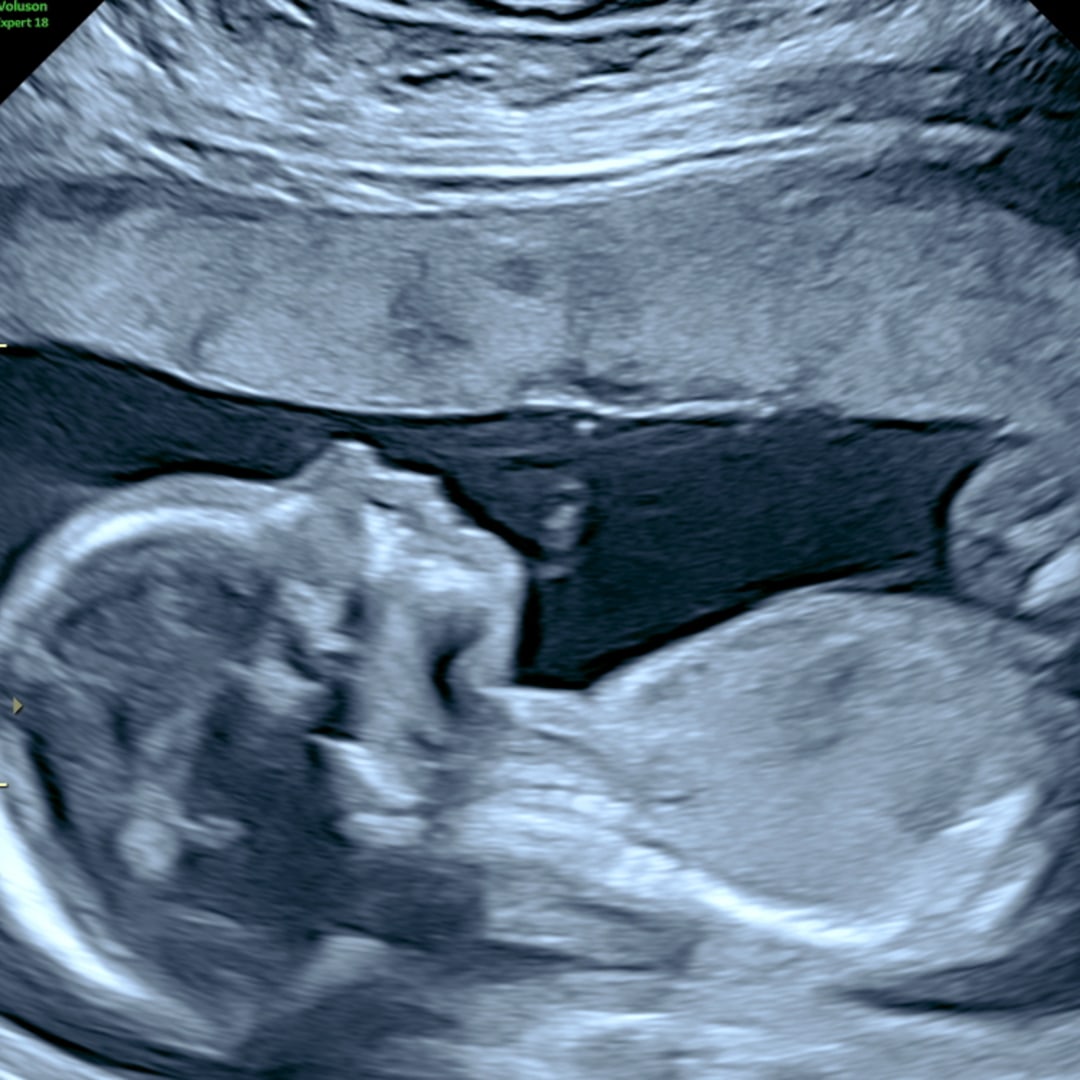 Photo shared by Abbie for their Babylist baby registry.