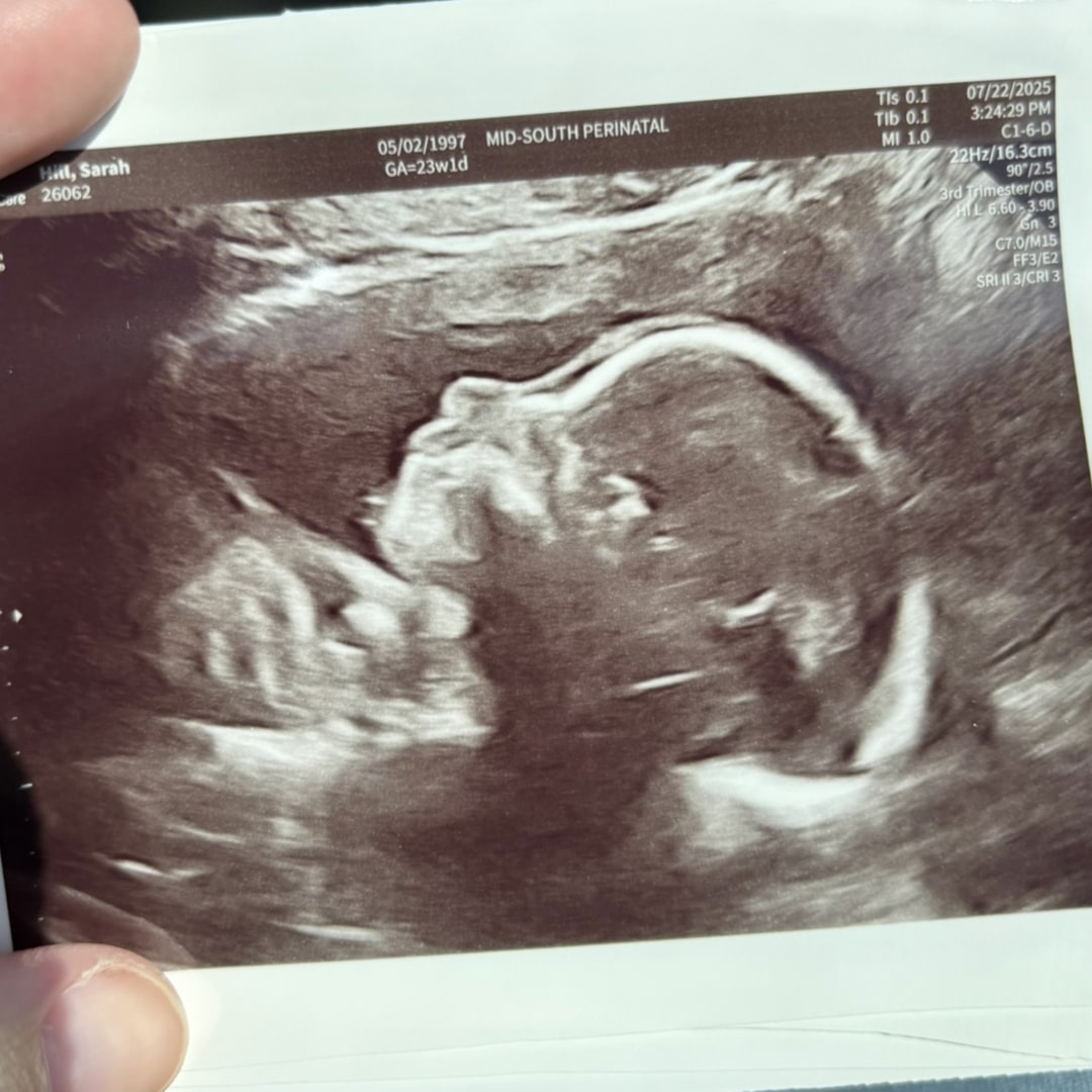 Photo shared by Sarah for their Babylist baby registry.