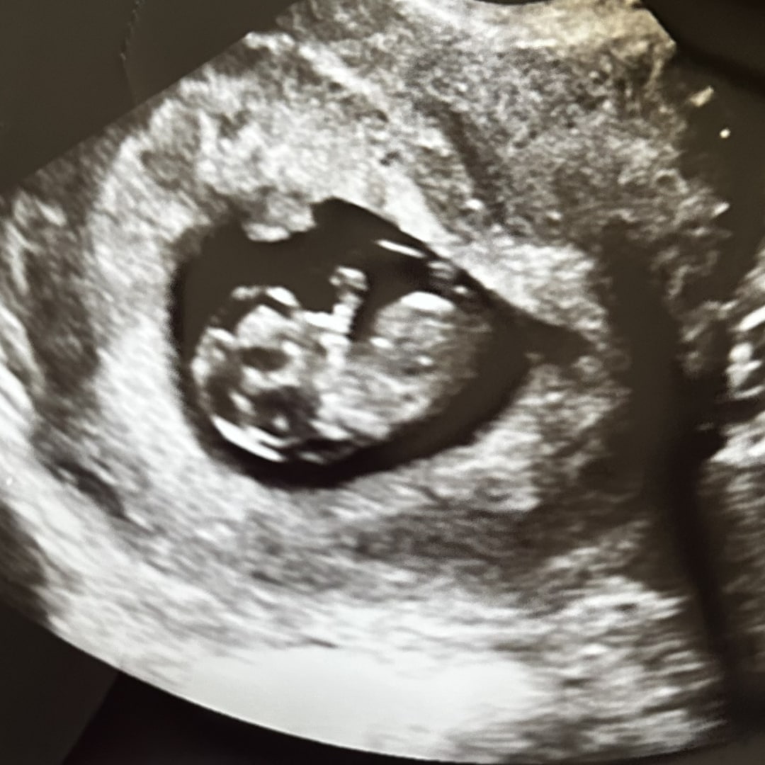 Photo shared by Aurora for their Babylist baby registry.