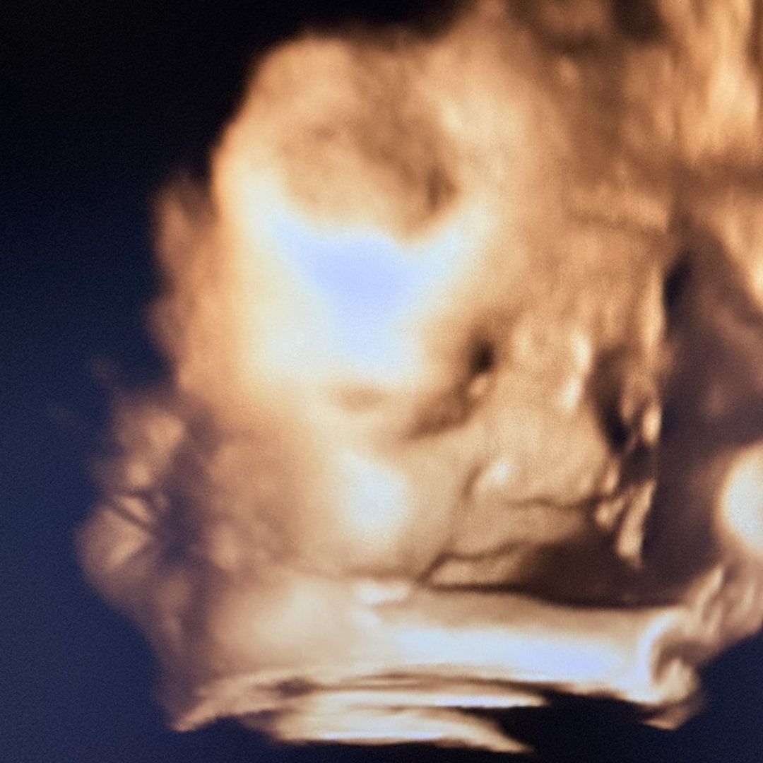 Photo shared by Kierra for their Babylist baby registry.