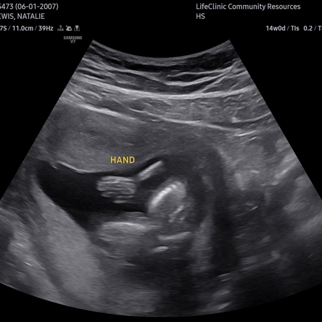 Photo shared by Natalie for their Babylist baby registry.