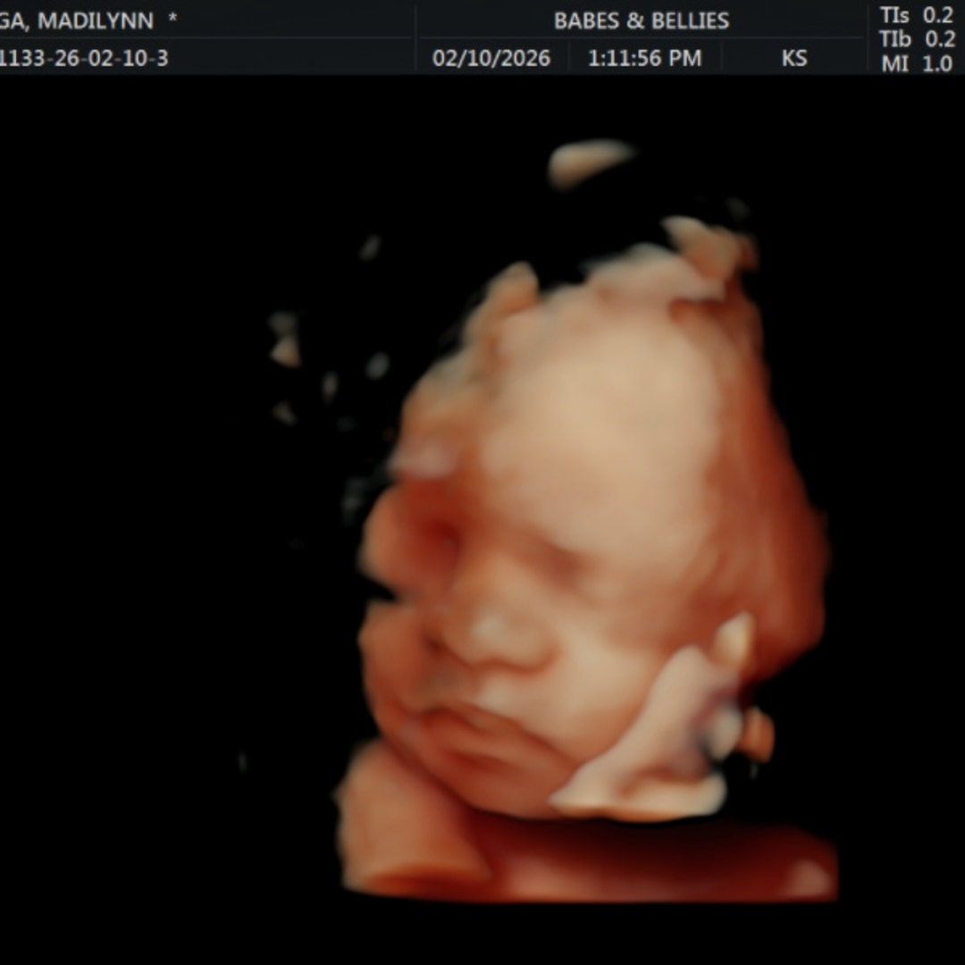 Photo shared by Madilynn & Jerry for their Babylist baby registry.