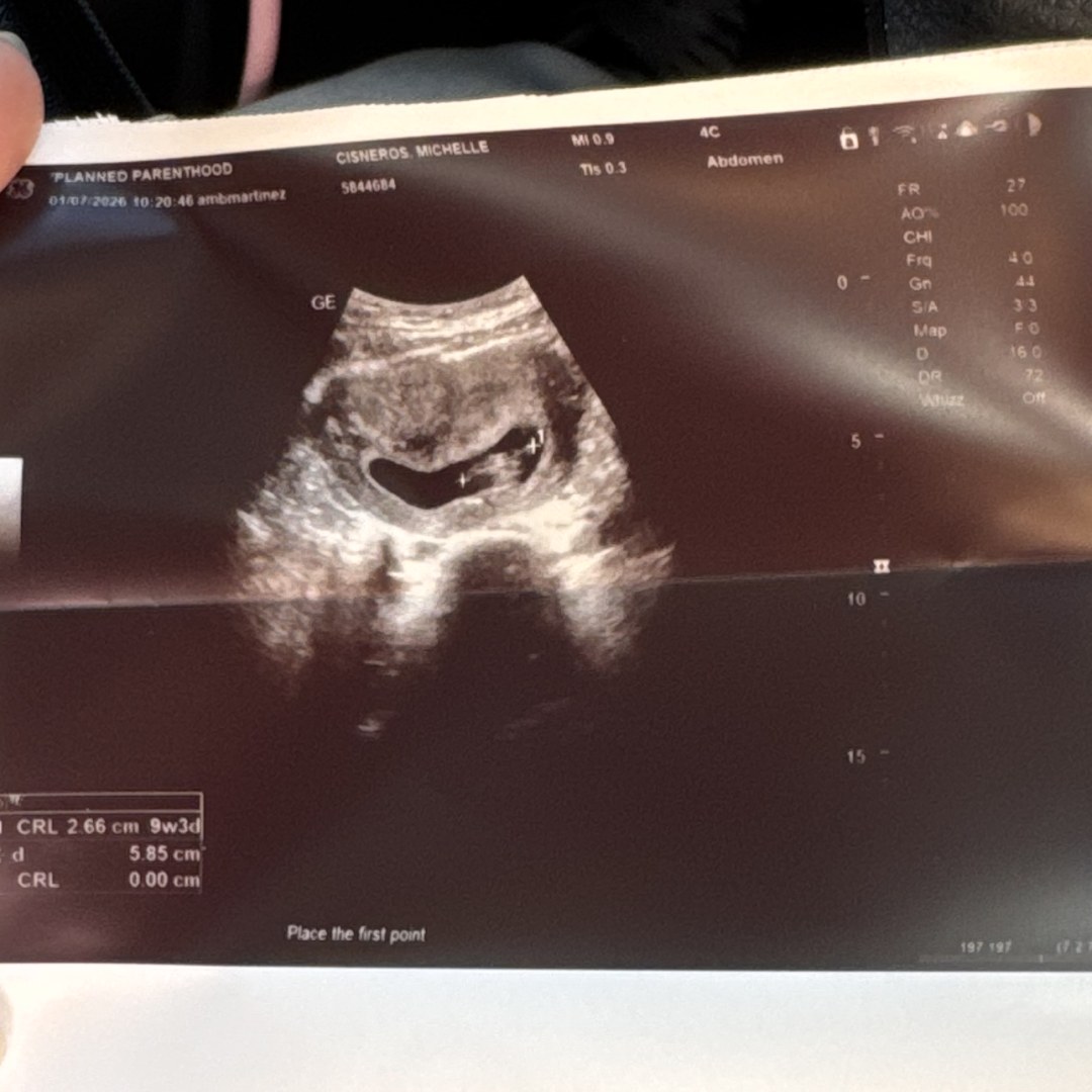 Photo shared by Michelle for their Babylist baby registry.