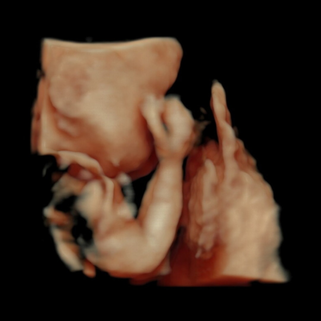 Photo shared by Meredith for their Babylist baby registry.