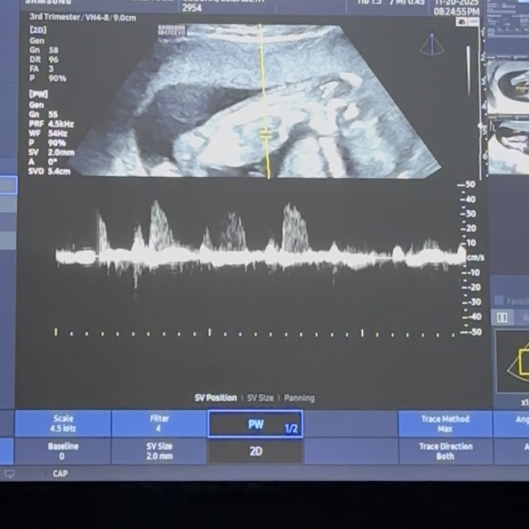 Photo shared by Elizabeth for their Babylist baby registry.