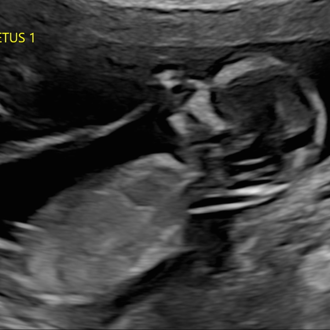 Photo shared by Jimmy for their Babylist baby registry.