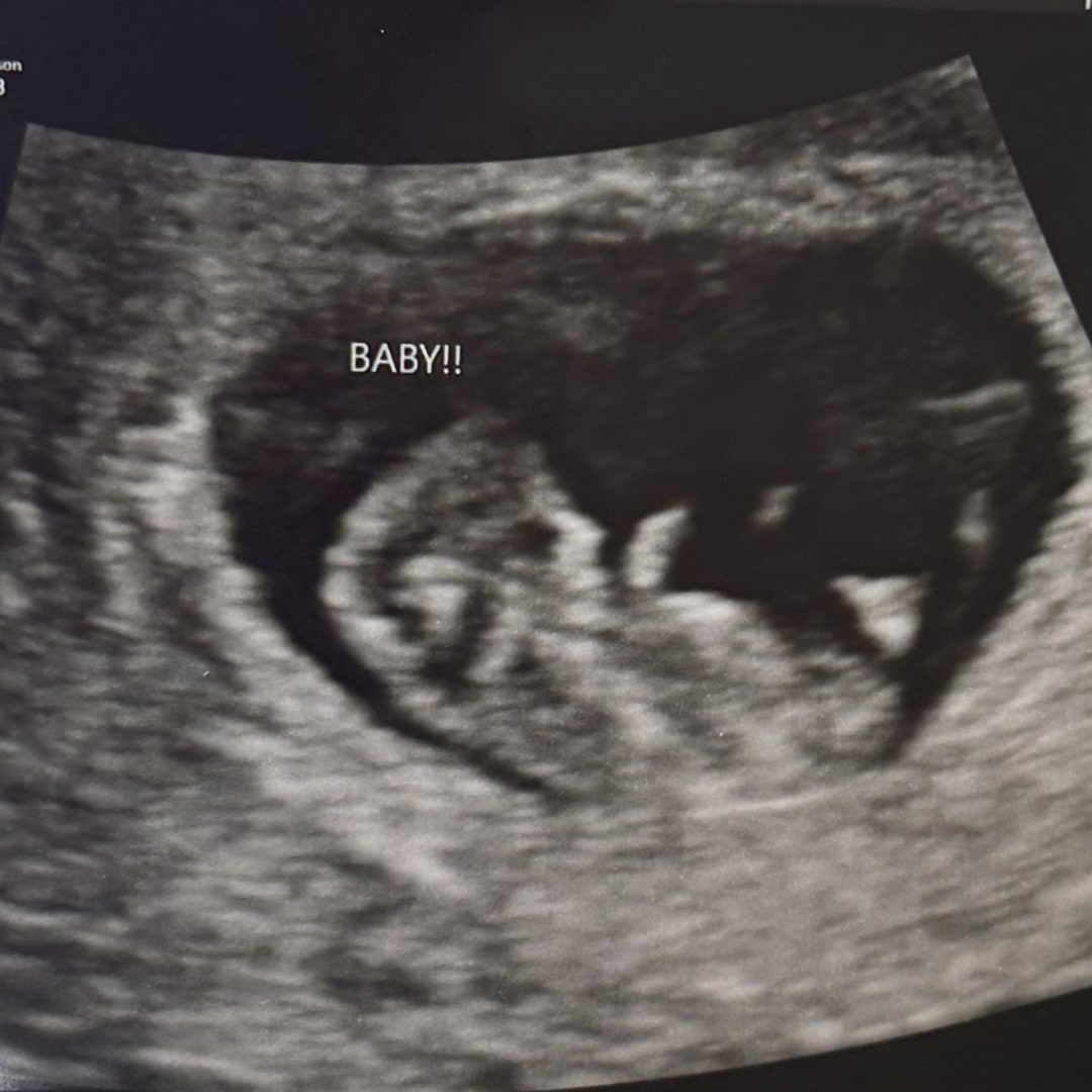 Photo shared by Dorismar for their Babylist baby registry.