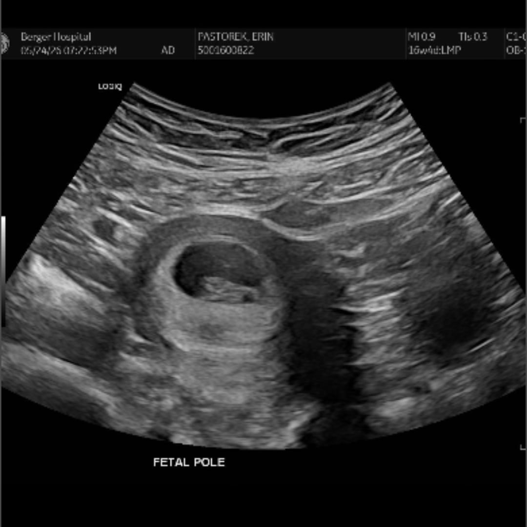 Photo shared by Erin for their Babylist baby registry.