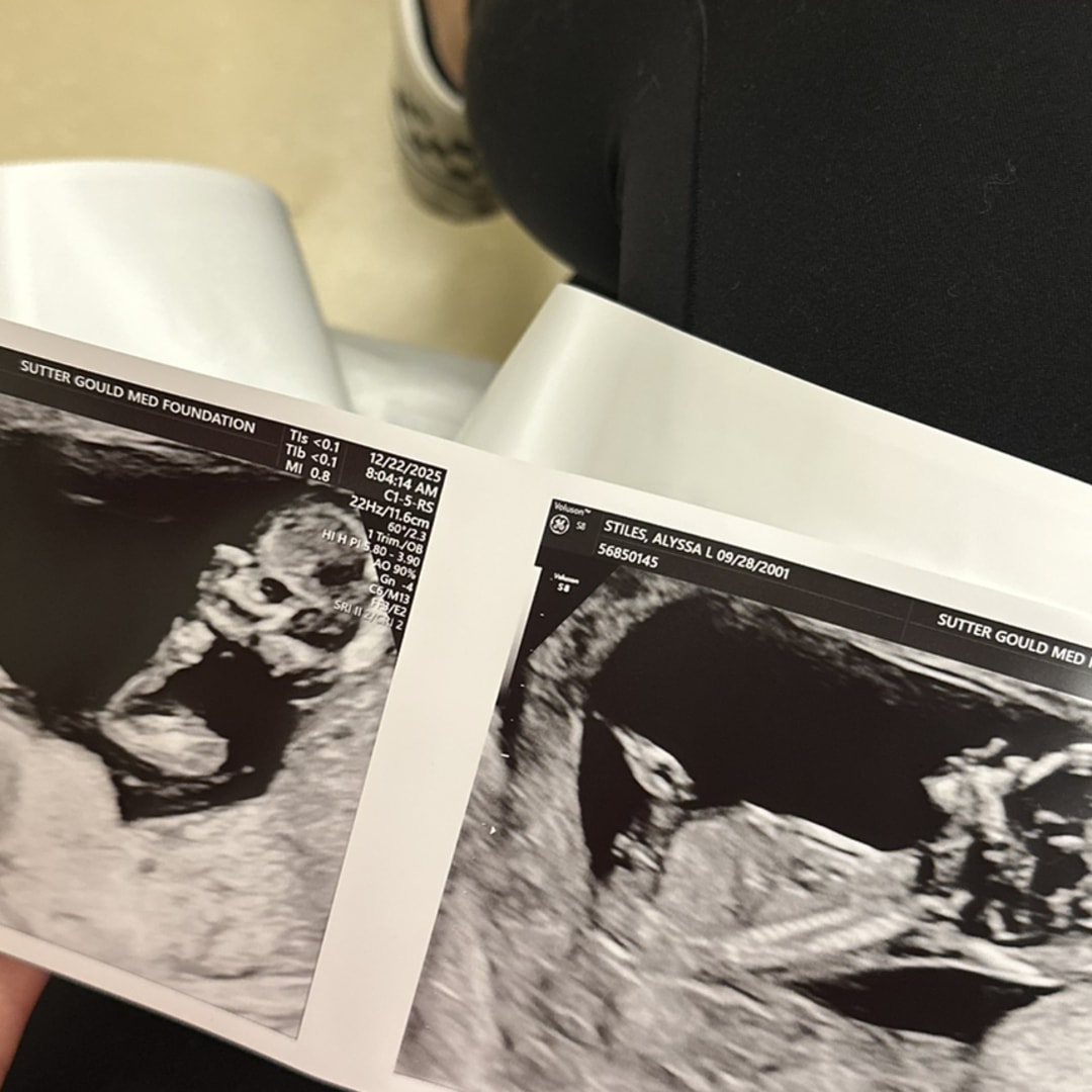 Photo shared by Alyssa for their Babylist baby registry.