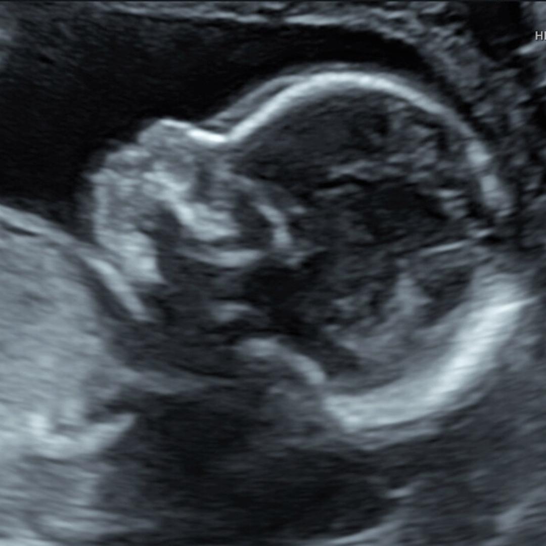 Photo shared by Mia for their Babylist baby registry.