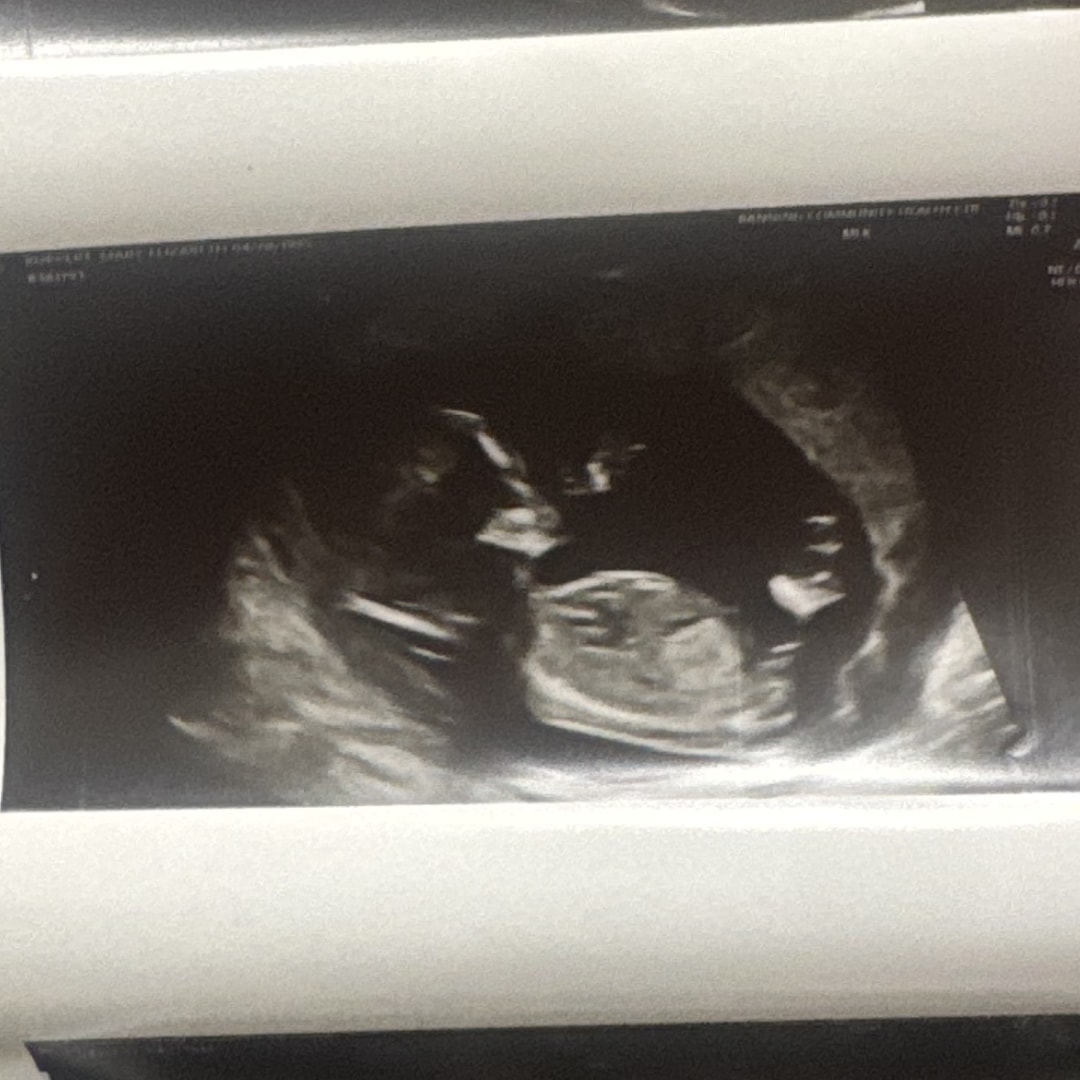 Photo shared by Mary for their Babylist baby registry.