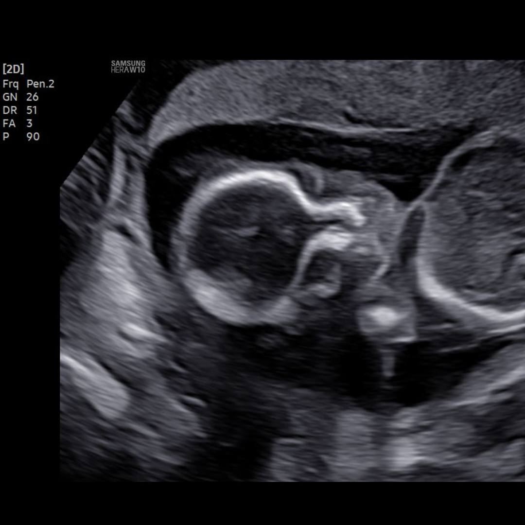 Photo shared by Sherry for their Babylist baby registry.