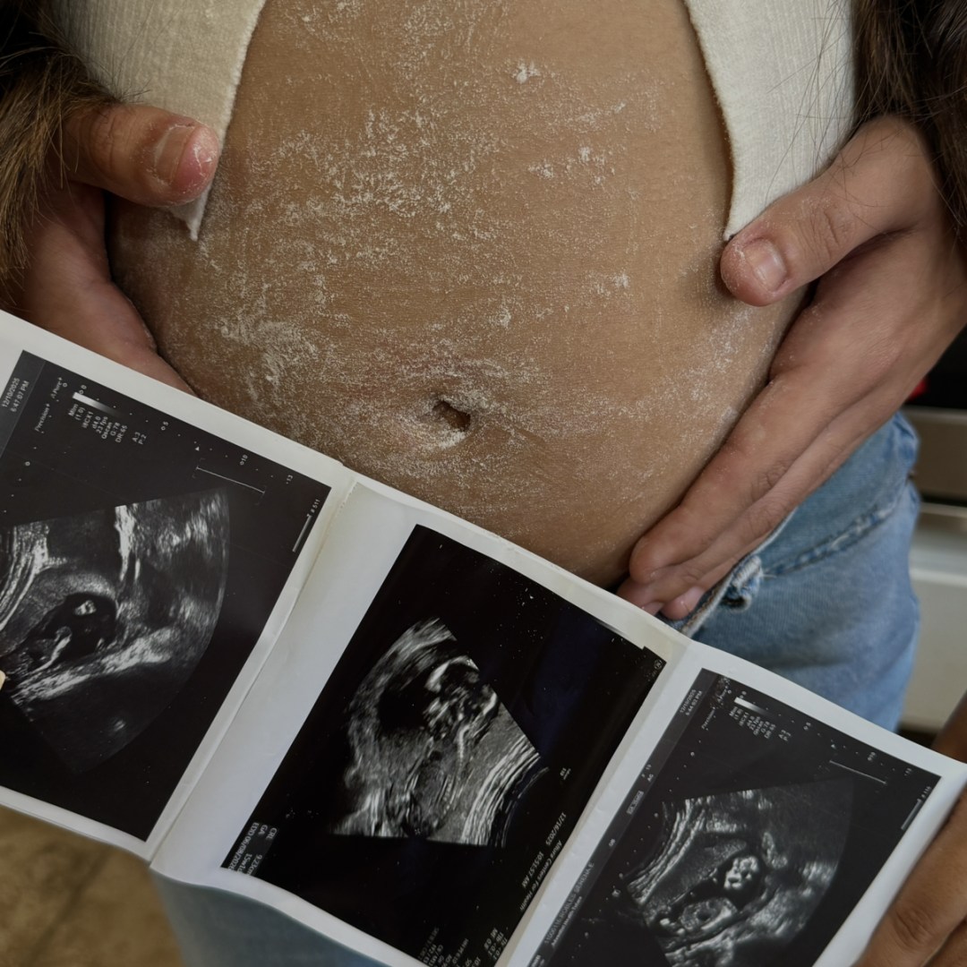 Photo shared by Serena for their Babylist baby registry.