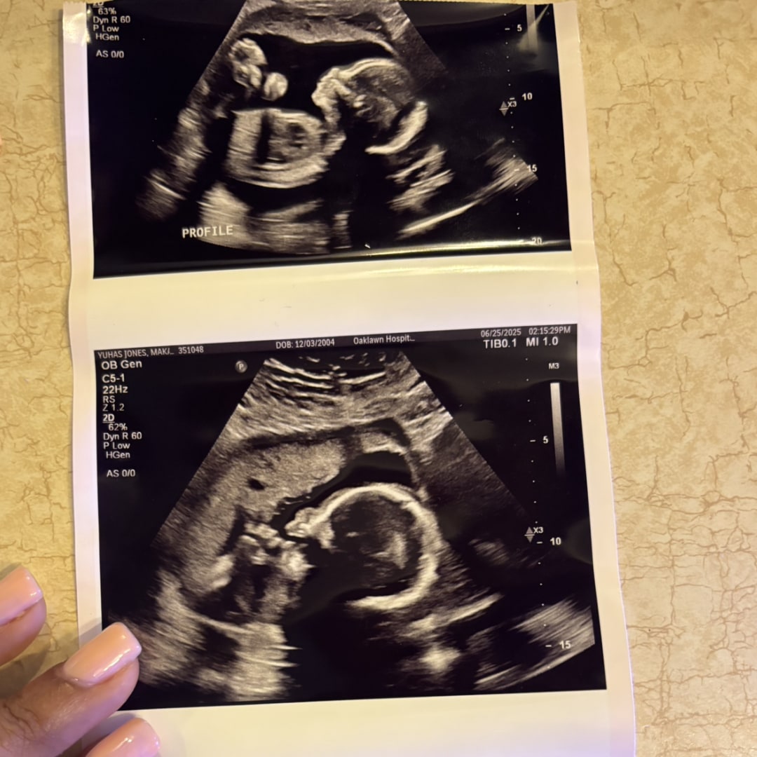 Photo shared by Makayla for their Babylist baby registry.