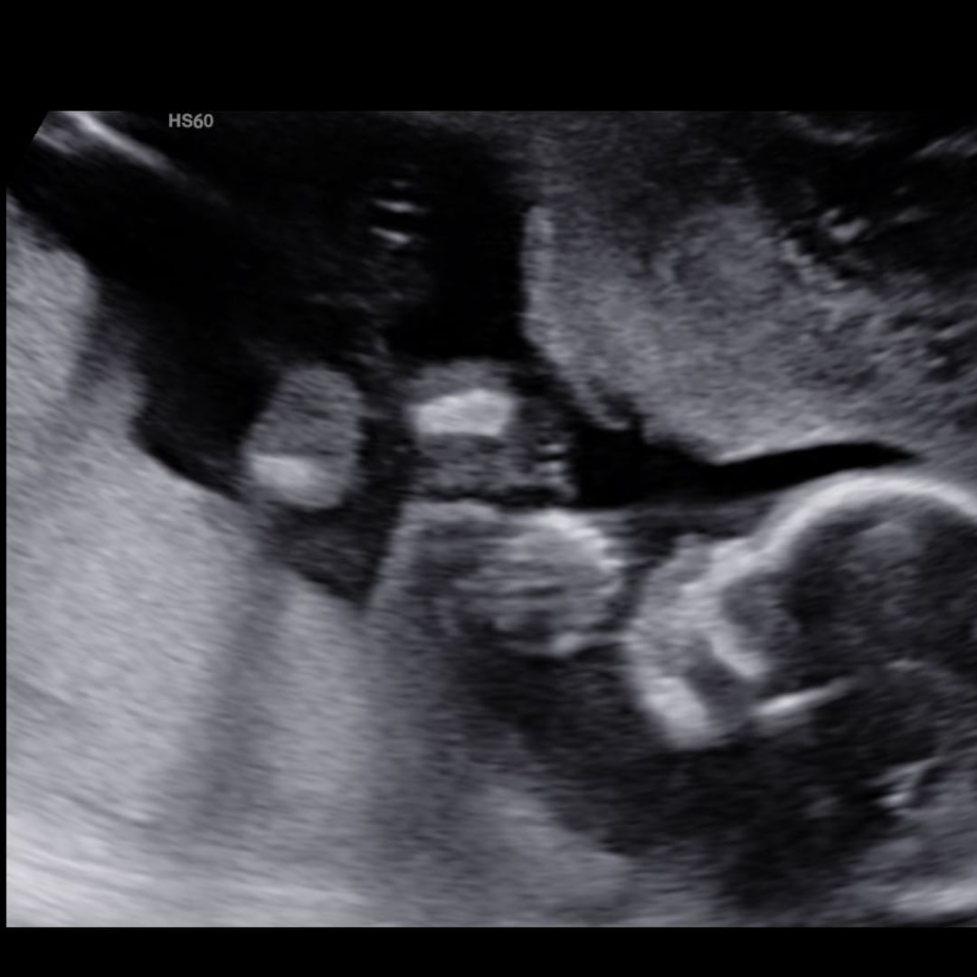 Photo shared by Aria for their Babylist baby registry.