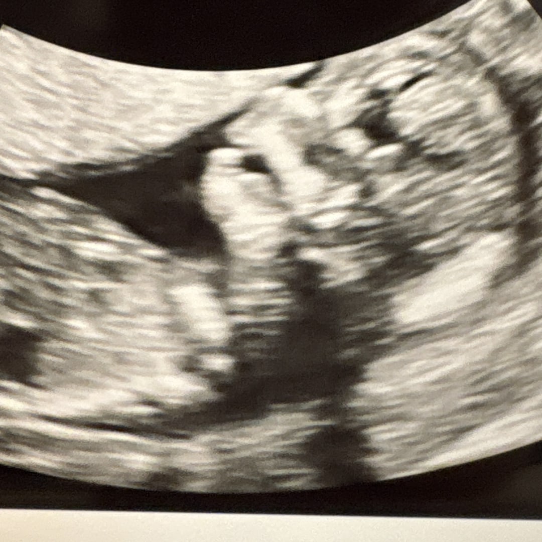 Photo shared by Hannah for their Babylist baby registry.