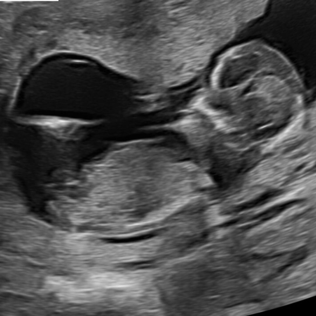 Photo shared by Queen Tyara for their Babylist baby registry.