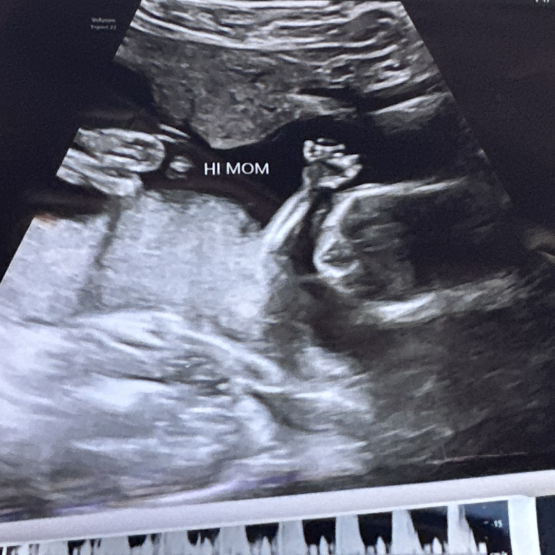 Photo shared by Tyler for their Babylist baby registry.