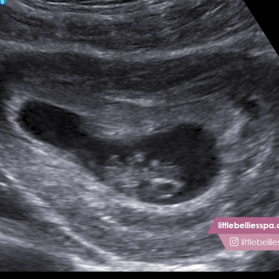 Photo shared by Faith for their Babylist baby registry.