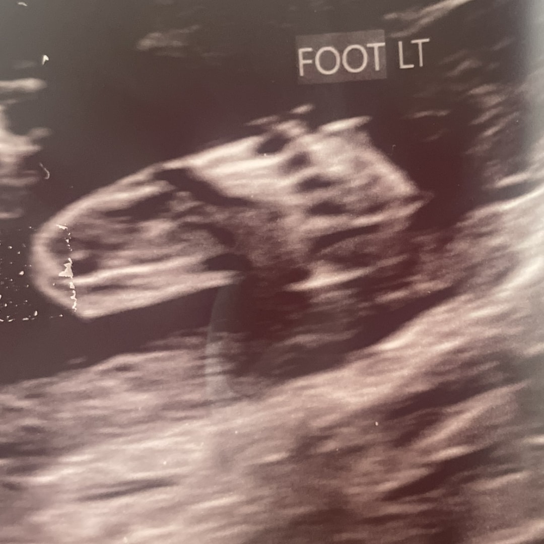 Photo shared by Haley for their Babylist baby registry.