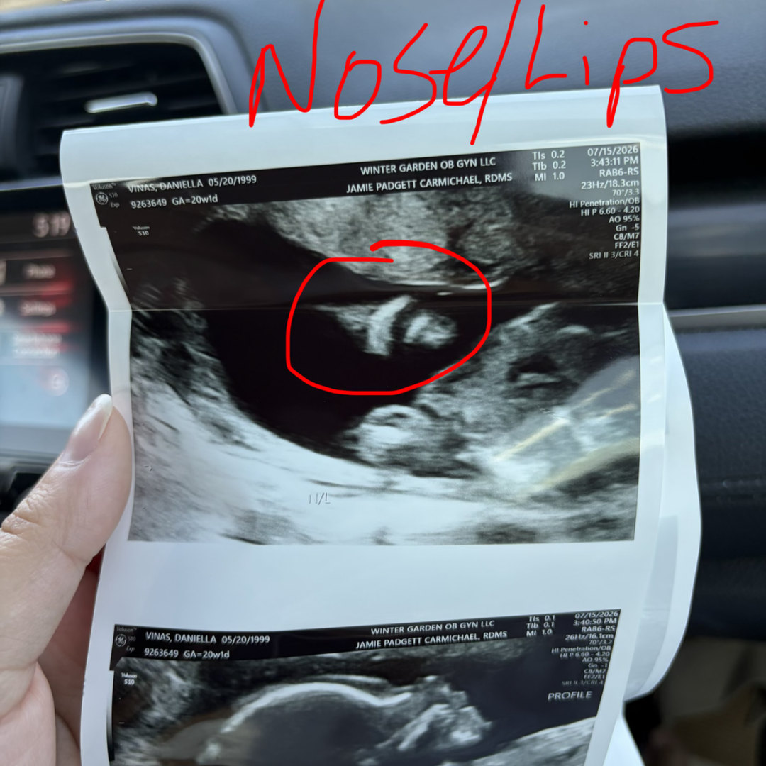 Photo shared by Daniella for their Babylist baby registry.