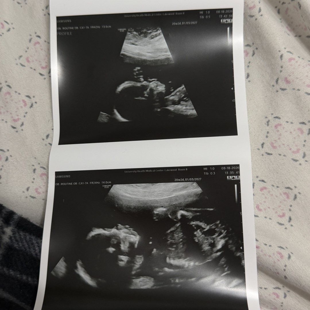 Photo shared by Annalise for their Babylist baby registry.