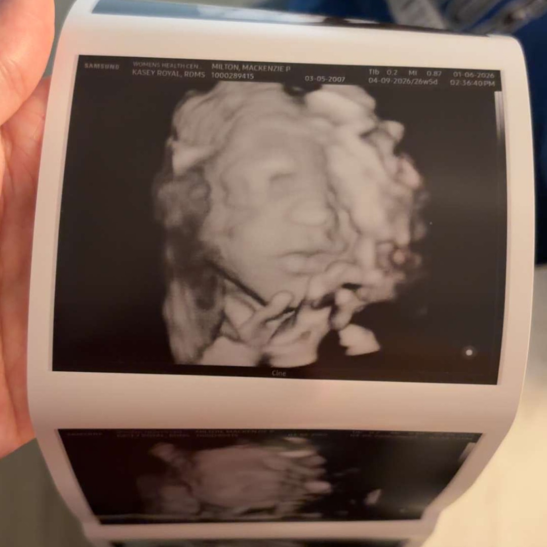 Photo shared by Mackenzie for their Babylist baby registry.