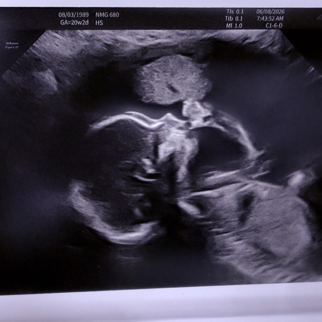 Photo shared by Nicole for their Babylist baby registry.
