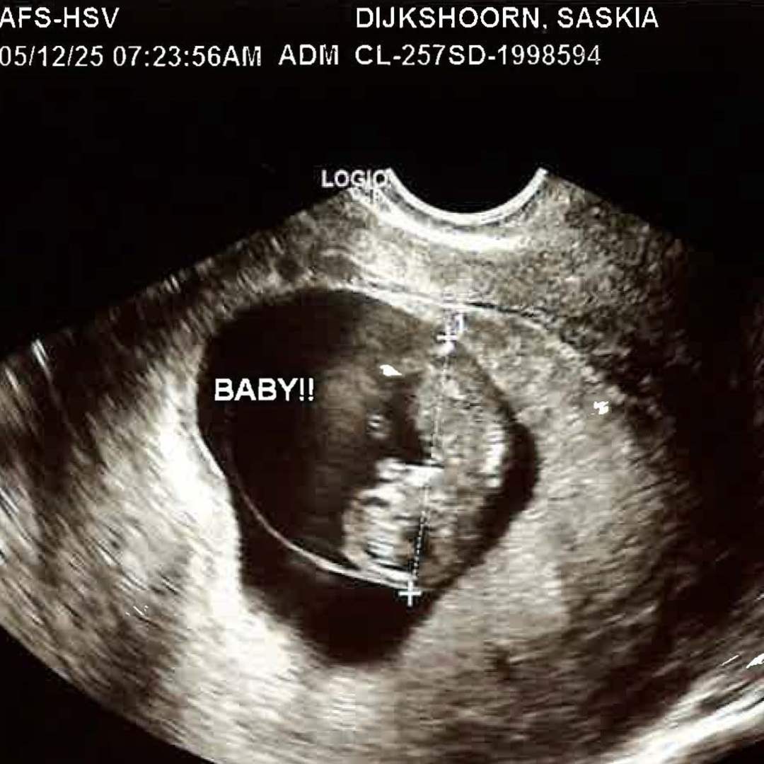 Photo shared by Lauren for their Babylist baby registry.