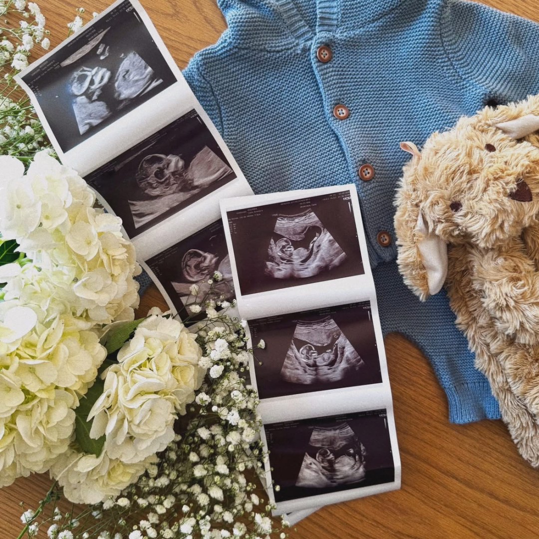 Photo shared by Amanda for their Babylist baby registry.