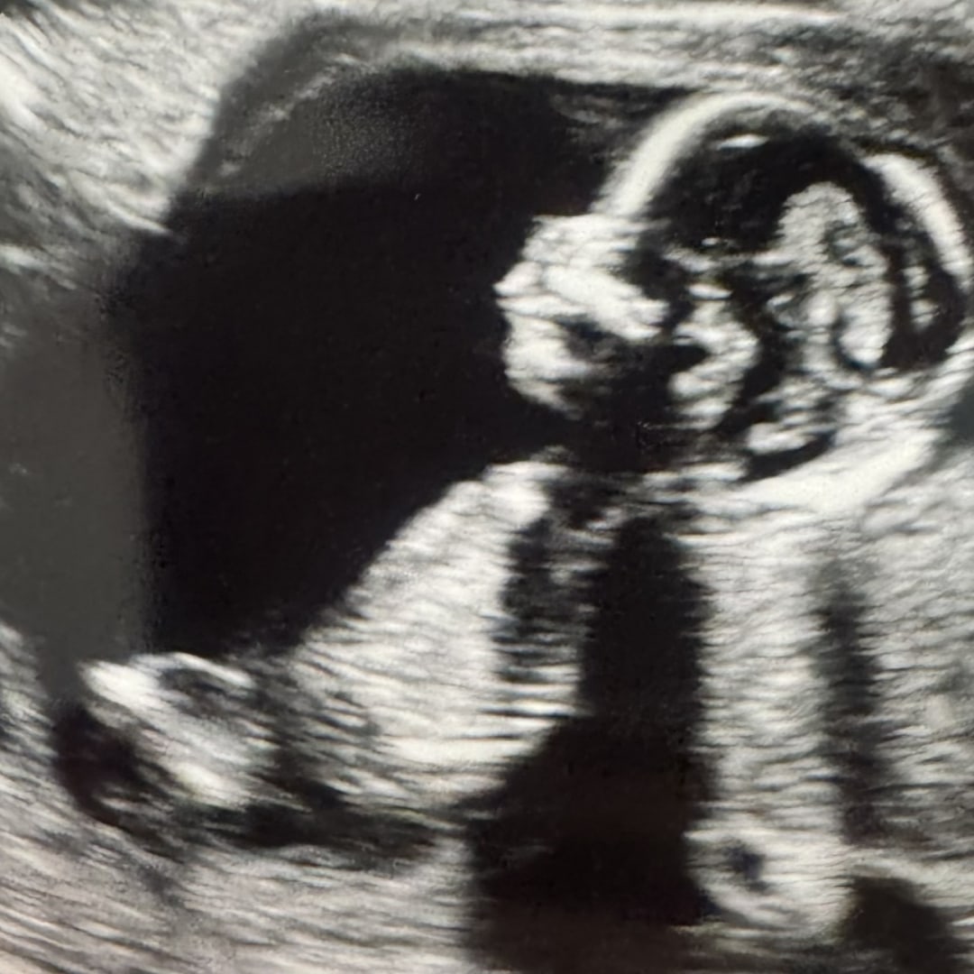 Photo shared by Lexi for their Babylist baby registry.