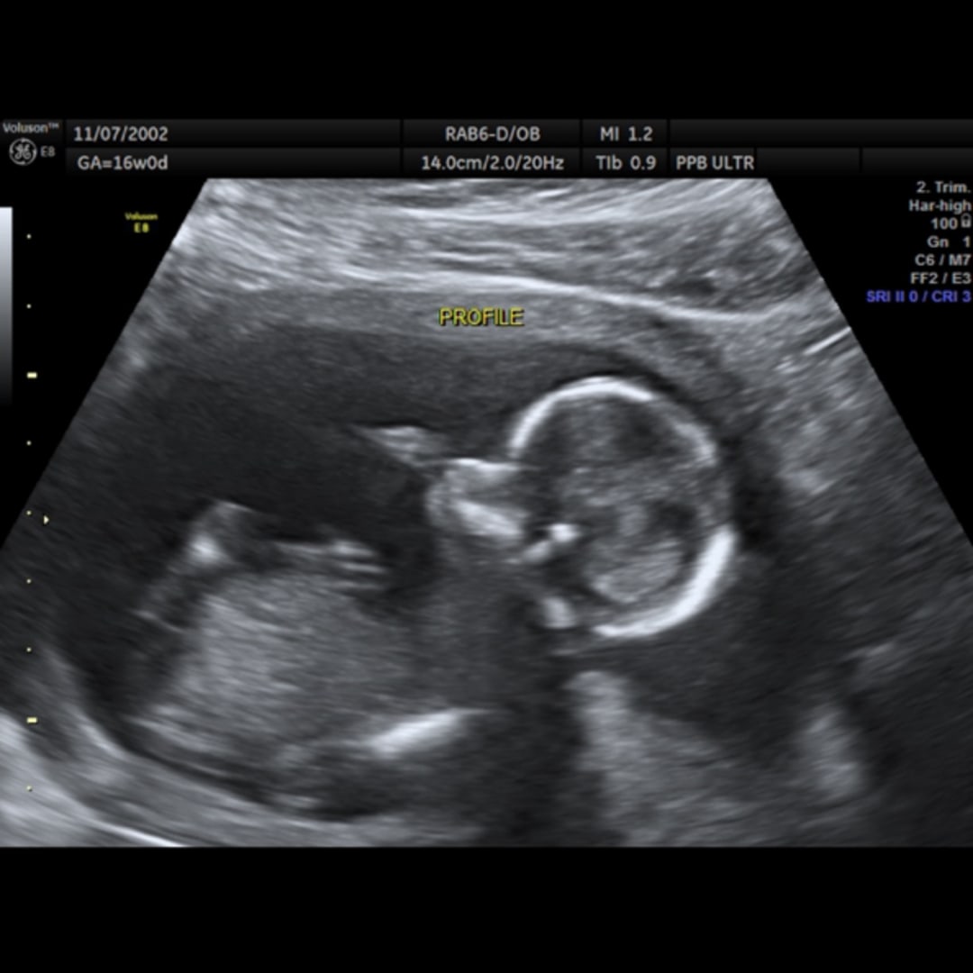 Photo shared by Haley for their Babylist baby registry.