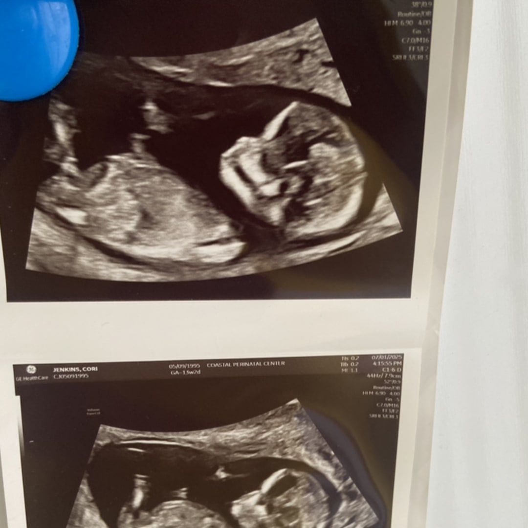 Photo shared by Cori for their Babylist baby registry.
