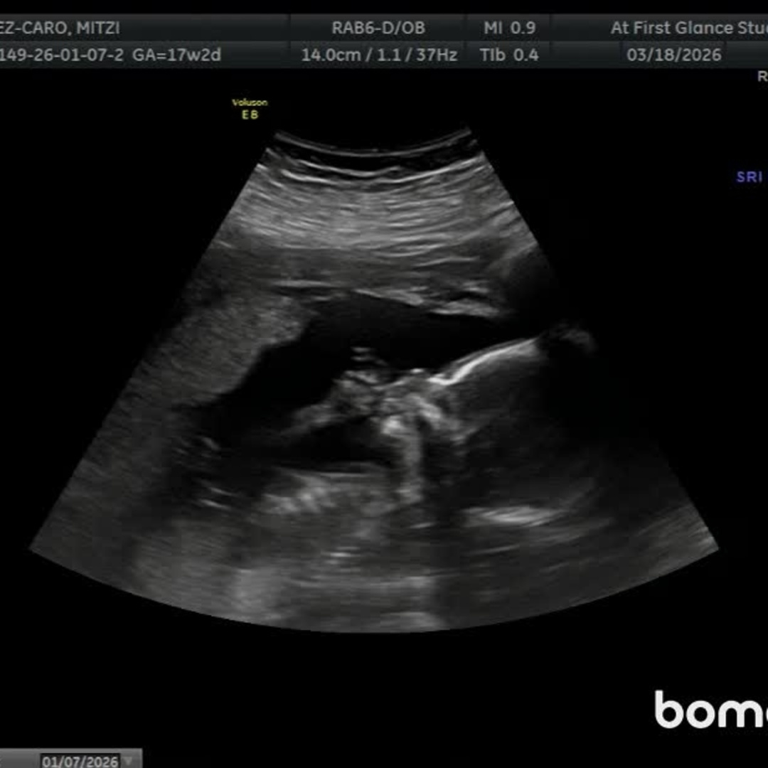 Photo shared by Anthony for their Babylist baby registry.