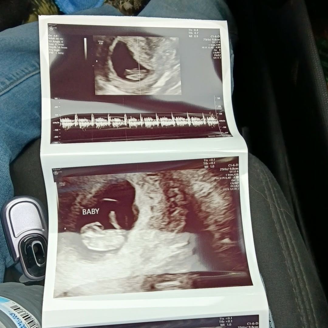 Photo shared by Erica for their Babylist baby registry.