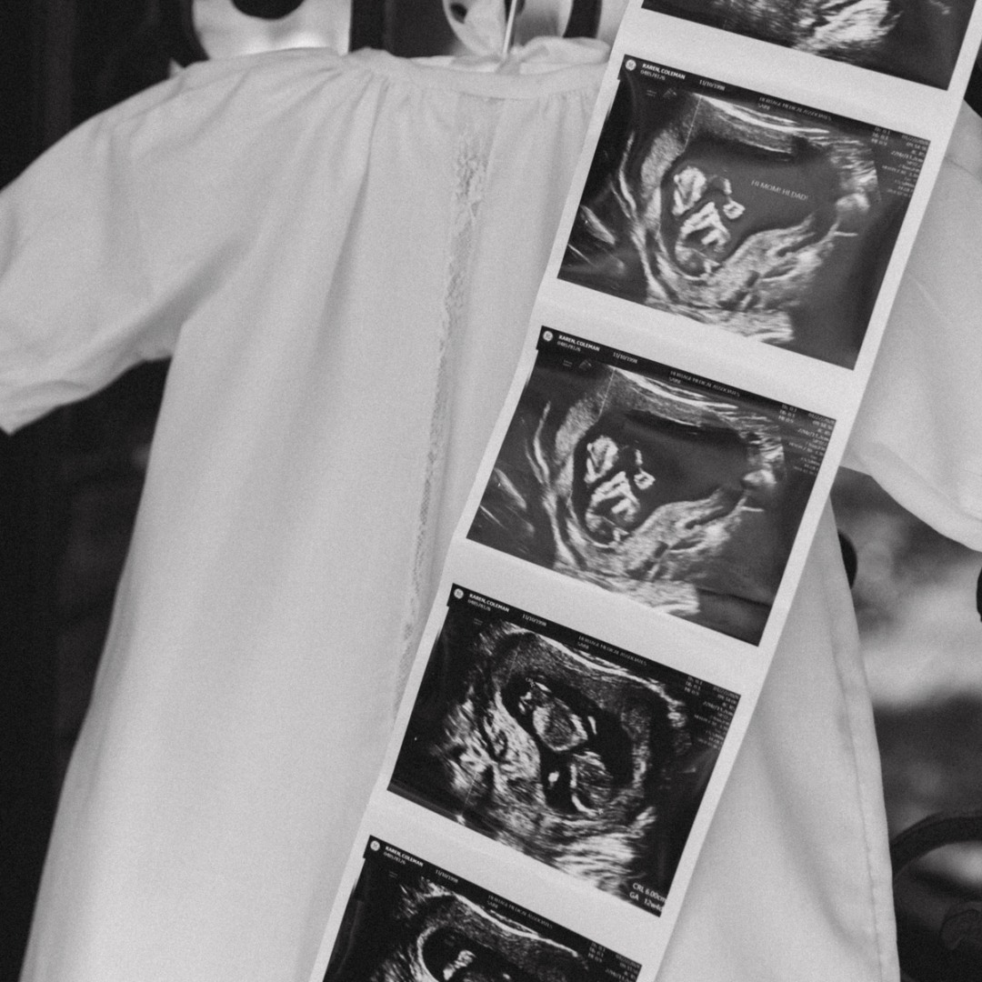 Photo shared by Karen for their Babylist baby registry.