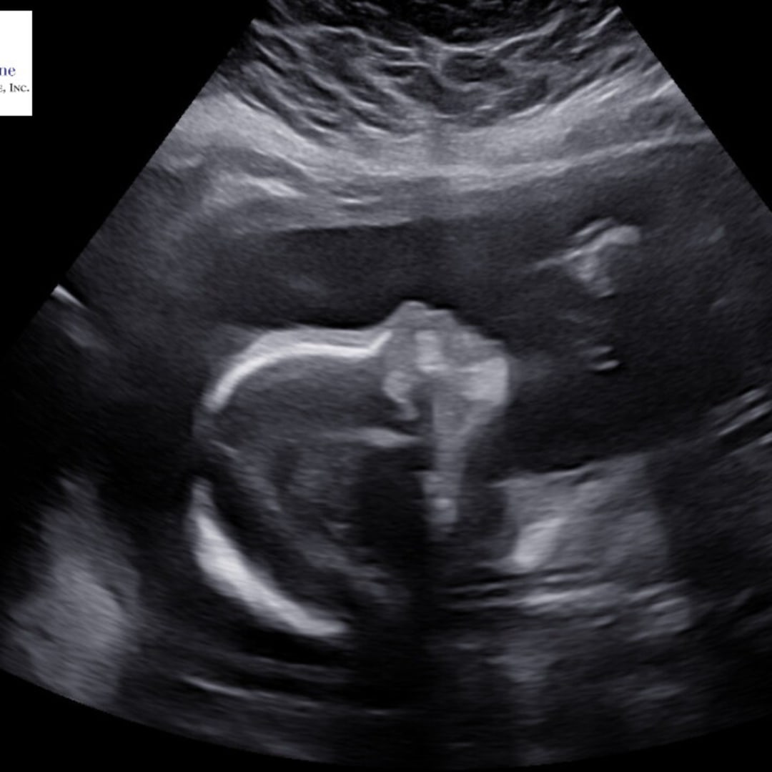 Photo shared by Alexia for their Babylist baby registry.