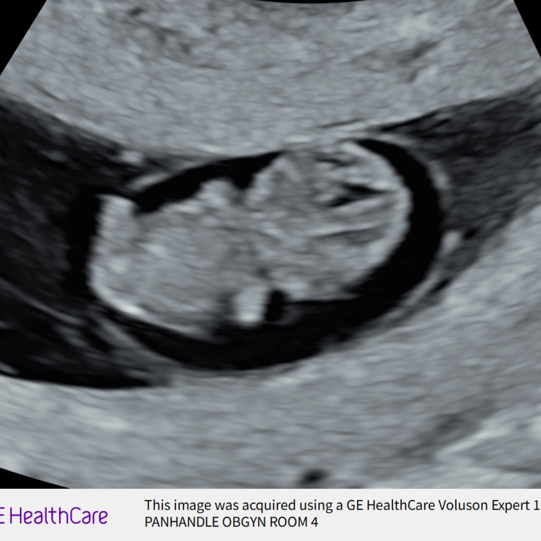 Photo shared by Cadence for their Babylist baby registry.