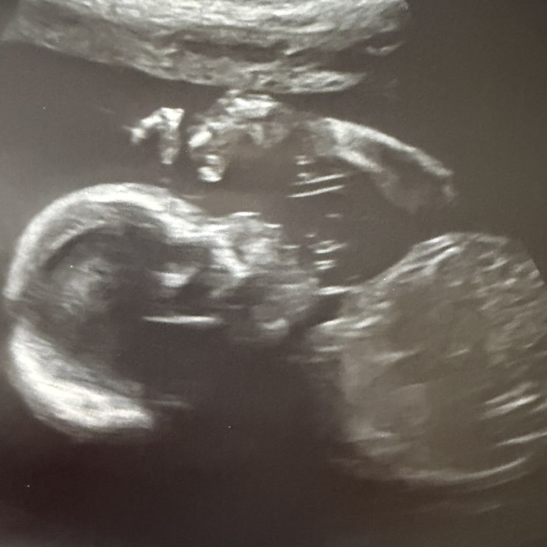 Photo shared by Sindy for their Babylist baby registry.