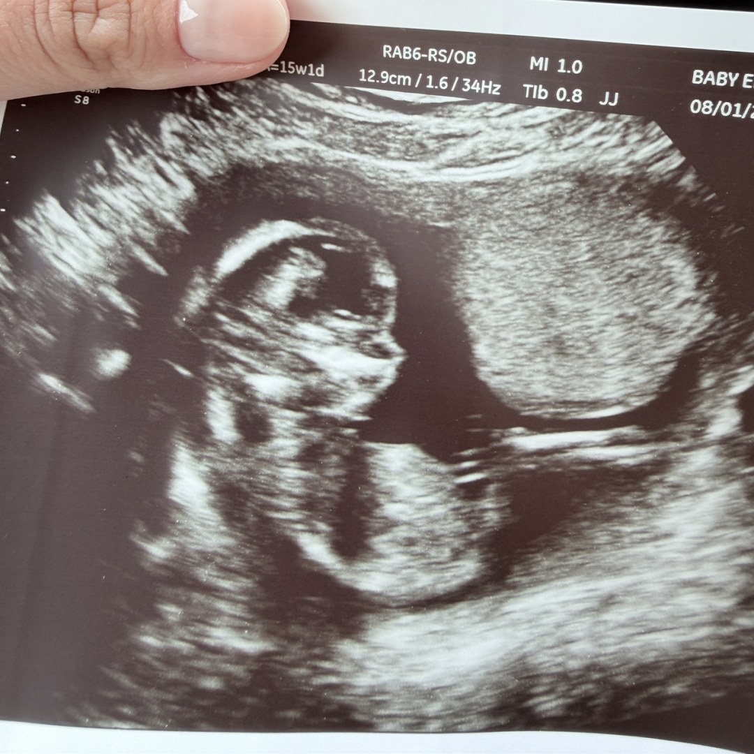 Photo shared by Brenna for their Babylist baby registry.