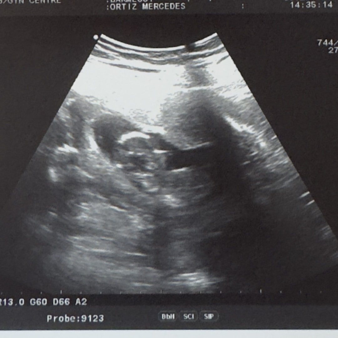 Photo shared by Mercedes for their Babylist baby registry.