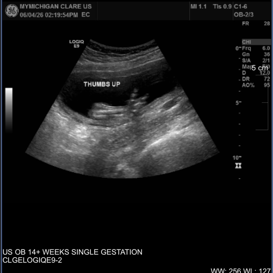 Photo shared by Erin for their Babylist baby registry.
