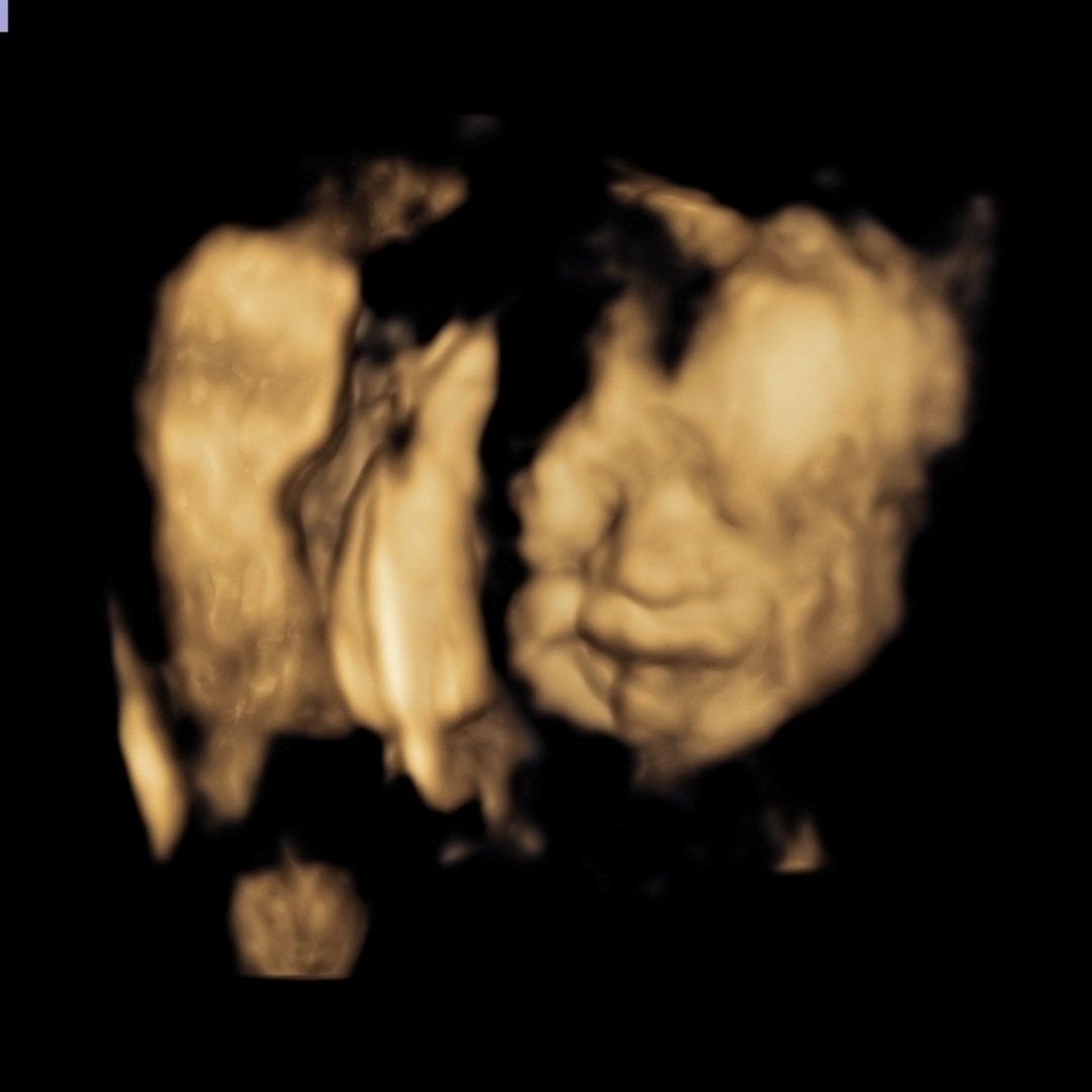 Photo shared by Emily for their Babylist baby registry.