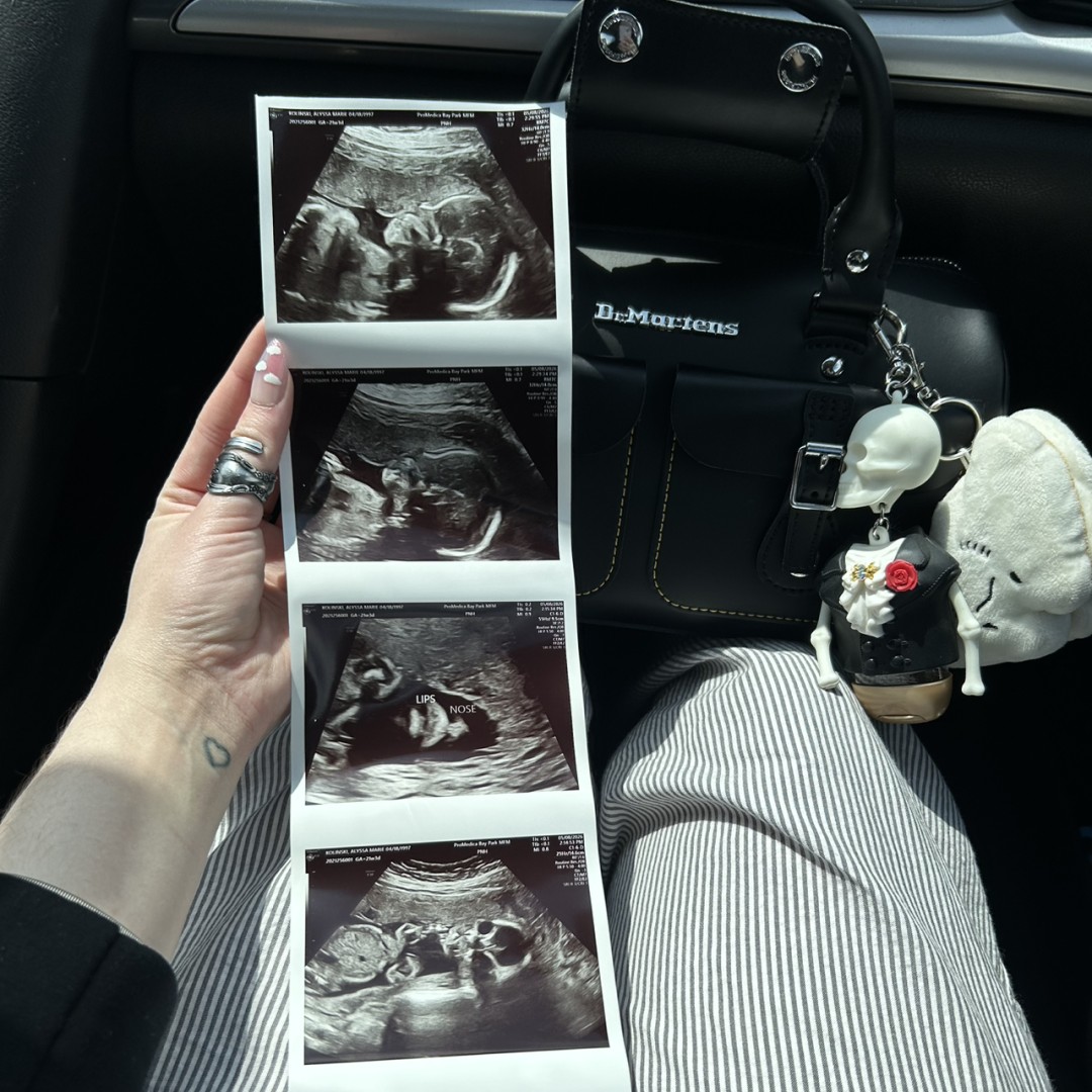 Photo shared by Alyssa for their Babylist baby registry.