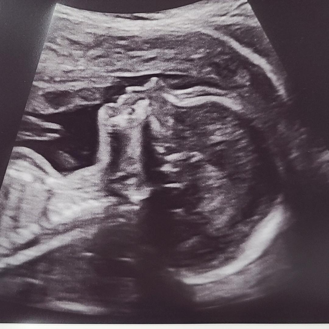 Photo shared by Lindsey for their Babylist baby registry.