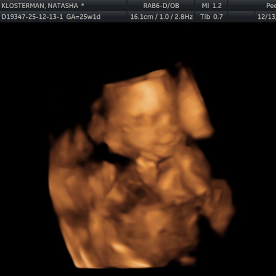 Photo shared by Natasha for their Babylist baby registry.